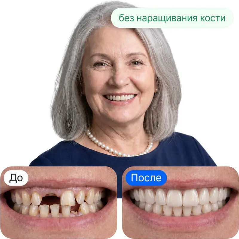 До и после лечения в клинике